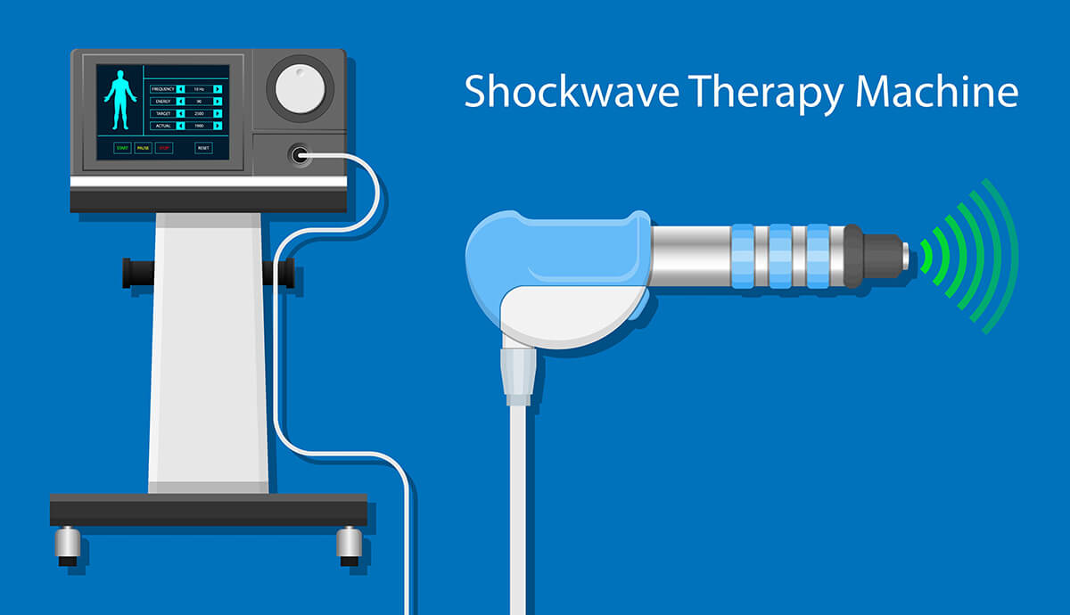 Shockwave machine diagram