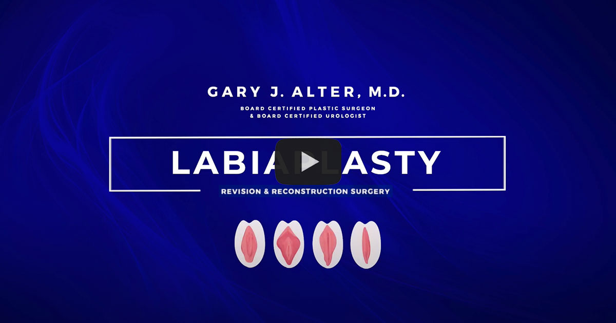 Video link: Labiaplasty Revision - Female Genital Surgery