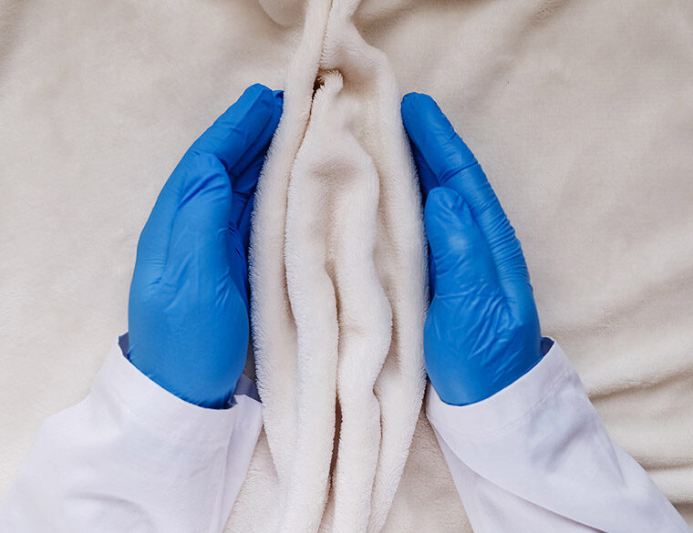 Surgeon holding blanket as Labiaplasty concept